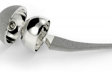 Prothesen für Knie und Hüfte: Haltbarkeit liegt bei über 25 Jahren