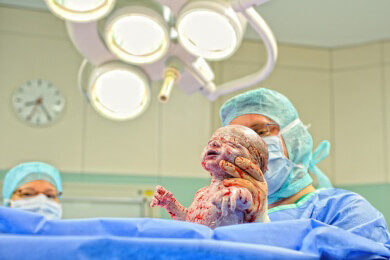 Komplikationen nach Kaiserschnitt bei älteren Müttern besonders häufig