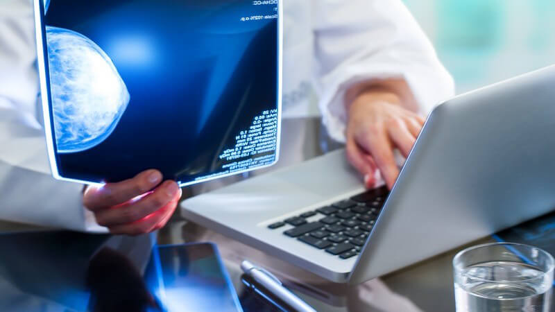 Frauenärztin sitzt am Laptop und betrachtet ein Röntgenbild einer Mammographie
