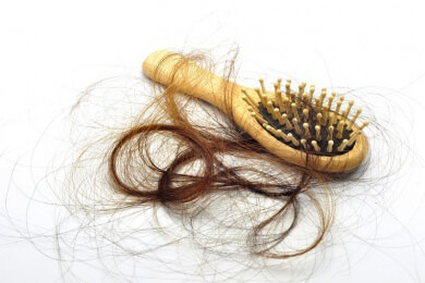 Maßgefertigtes Haarteil bei teilweisem Haarverlust - Gericht verurteilt Krankenkasse zur Zahlung