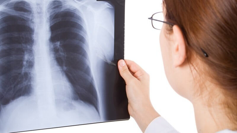 Ärztin mit Brille betrachtet ein Röntgenbild der Lunge