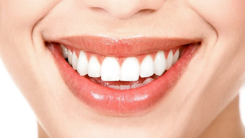 Nahaufnahme Unterer Teil des Gesichts einer Frau, lächelnder Mund, makellose, weiße Zähne, helle Haut, Hintergrund weiß