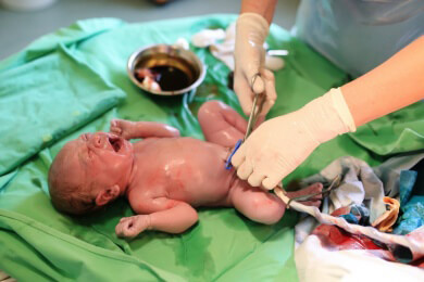 Verzögerte Abnabelung ungefährlich für Mutter und Kind, allerdings nicht für Frühchen
