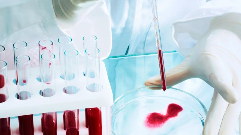Blutproben in Reagenzgläsern in Labor