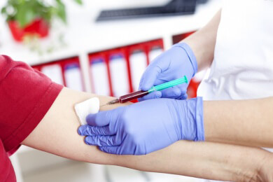 Bluttest auf Lungenkrebs: Biomarker erlaubt frühe Diagnose