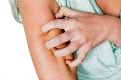 Atopische Dermatitis: Quälender Juckreiz könnte durch neue Antikörpertherapie gelindert werden