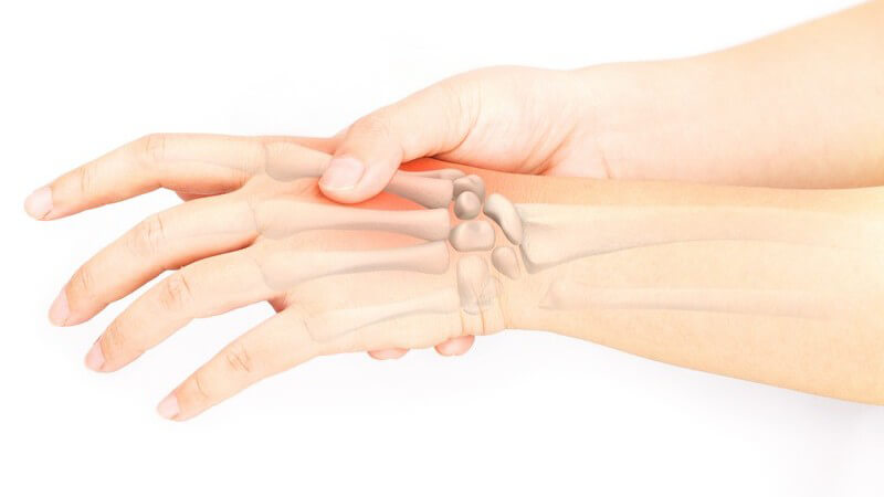 Rechte Hand hält die linke Hand, Schmerzen an den Handknochen, die Knochen scheinen durch (Fotomontage)