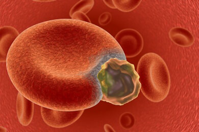 Löchrige Zellmembrane als mögliche Ursache für Alterskrankheiten