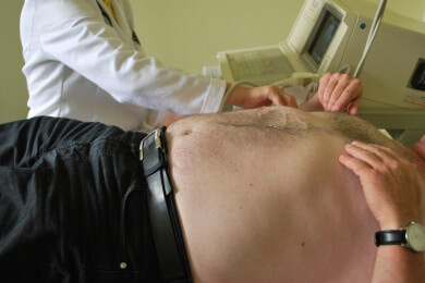 Unbekannte Genvarianten der möglichen Entstehung von Adipositas gefunden