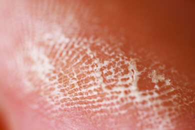 Warum die Haut an den Fingerspitzen geriffelt ist