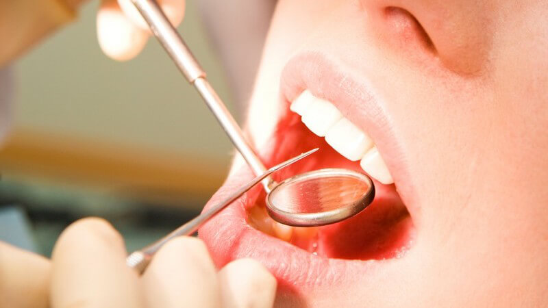 Nahaufnahme weibliches Gesicht, Frau mit offenem Mund bei Zahnuntersuchung