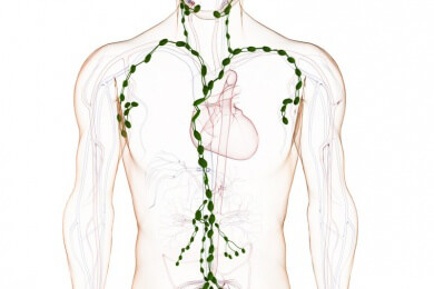 Müssen bei einer Tumorentfernung sofort auch alle Lymphknoten entfernt werden?