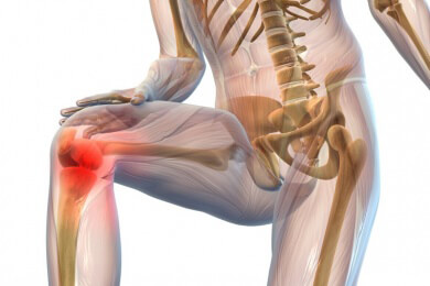 Arthrose ist ein Zeichen der Zeit