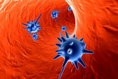 Ist ein Virus Schuld an dem Chronischen Erschöpfungssyndrom (CFS) ?