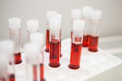 Blutwerte sollen in einer Datenbank "Biomax" archiviert werden