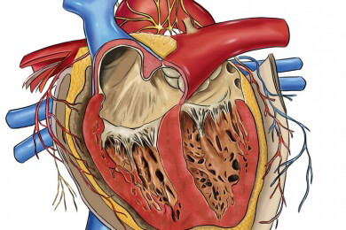 Parallele zwischen Alzheimer und Herzinsuffizienz aufgrund ähnlicher Entstehung