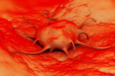 Plastikscheibe könnte zukünftig als eine Art Krebs-Impfung gegen Tumore helfen