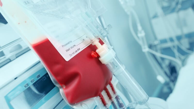 Rote Blutkonserve hängt an einem medizinischen Gerät auf der Intensivstation