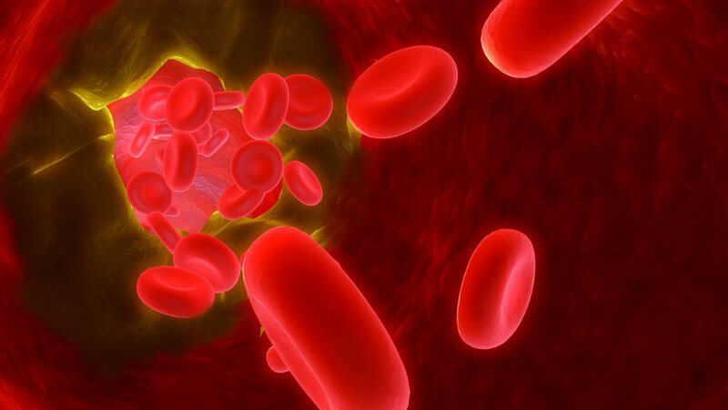 3D Grafik Arteriosklerose, Blutzellen in Blutbahn mit Ablagerungen an Gefäßwänden