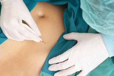 Viren als mögliche Ursache einer Blinddarmentzündung