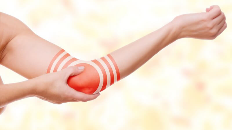 Gebeugter Arm mit Ellbogenschmerzen, Ellbogen rot markiert