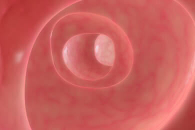 Mit einem Frühjahrsputz des Darms zur Vorsorgeuntersuchung