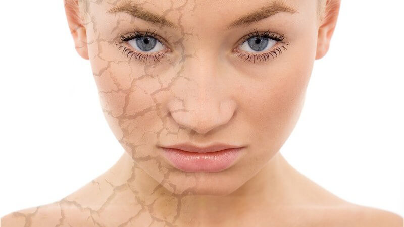Gesicht einer jungen Frau, rechte Seite grafisch bearbeitet, trockene, poröse Haut