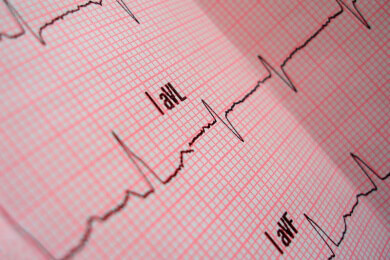 Depressionen und Angstzustände: Patienten mit Herzrhythmusstörungen besonders betroffen