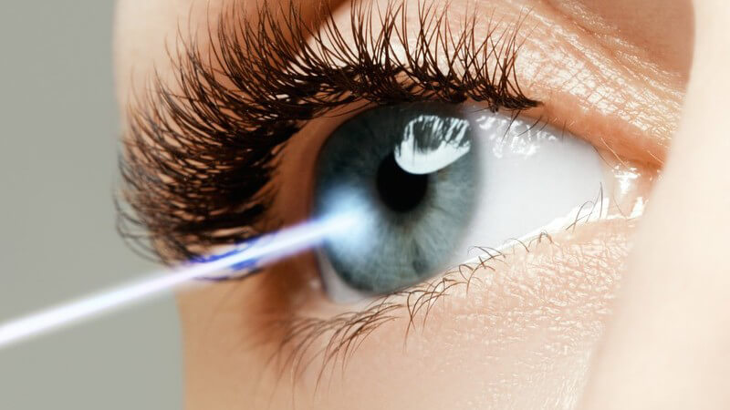 Laserstrahl trifft auf die Linse des rechten Auges einer Frau (LASIK)