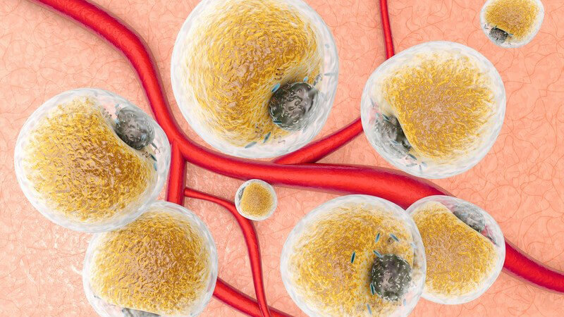 3-D-Grafik des Gewebes mit roten Blutgefäßen und vielen Fettzellen