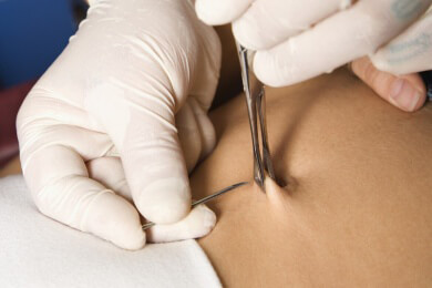 Achtung, auf Piercing-Patienten warten unerwartete Nebeneffekte