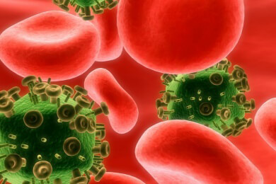 Vaginalgel soll die Übertragung von Aids verhindern