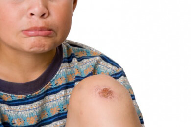 Die richtige Behandlung von Schürfwunden