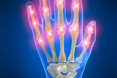 Rheuma lässt sich durch eine frühe Diagnose und entsprechende Therapie zum Teil vermeiden