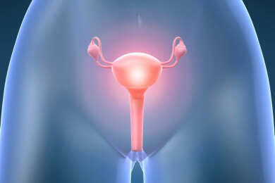 Hormonersatztherapie kann Krebs in den Eierstöcken fördern