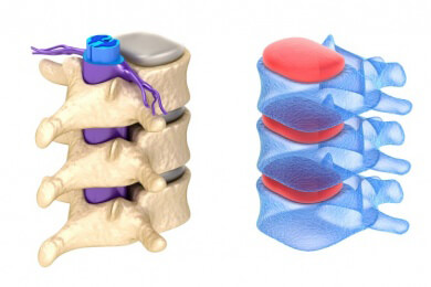 Schäden am Rückenmark können auch von alleine heilen