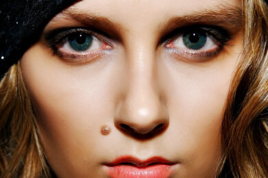 Muttermale lassen Menschen langsamer altern