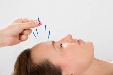 Akupunktur ist doch gut gegen Migräne