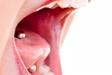 Zahnausfall wegen Piercing