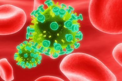 HIV-Patienten erleiden häufiger einen Schlaganfall als andere