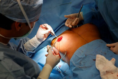 Finger weg, wenn die OP weniger als 5000 Euro kostet