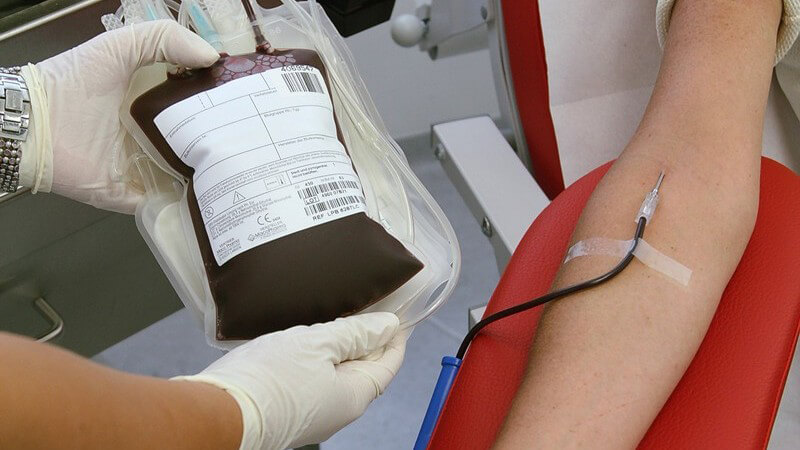 Volle Blutkonserve bei einer Blutspende - Aus einem Arm wird Blut abgezapft