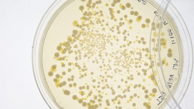 Bakterienkultur auf Petrischale, weißer Hintergrund
