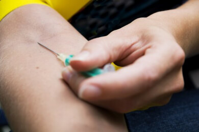 Melanotan - ein illegales Medikament aus dem Internet versetzt Ärzte in Alarmbereitschaft