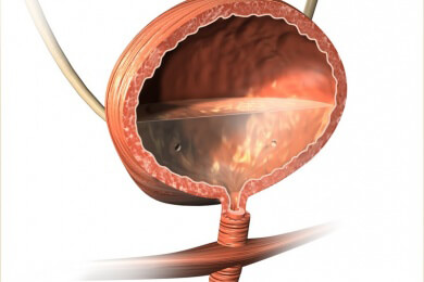 Die besten Entscheidungen trifft man mit gefüllter Blase