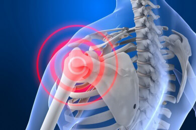 Neuer Ansatz zur Behandlung von Osteoporose - ein Eiweiß soll den Knochenabbau stoppen