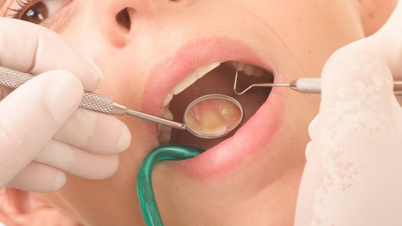 Untersuchung - Zahnarzt untersucht die Zähne einer jungen Frau mit Spiegel und Kratzer