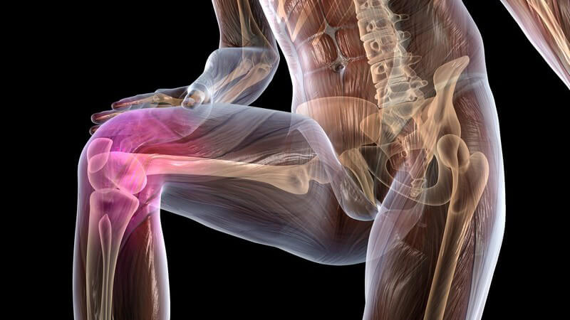 Grafik männlicher Körper mit Knieschmerzen