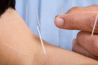 Akupunkturerfolg hängt von Kommunikation ab