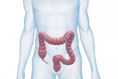 Wenn kolikartige Bauchschmerzen auftreten, kann es sich um eine Divertikulitis handeln